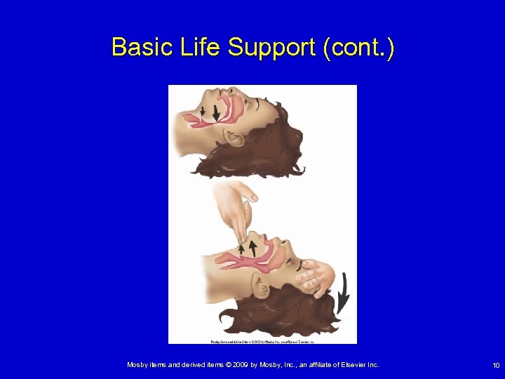Basic Life Support (cont. ) Mosby items and derived items © 2009 by Mosby,