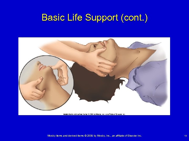 Basic Life Support (cont. ) Mosby items and derived items © 2009 by Mosby,