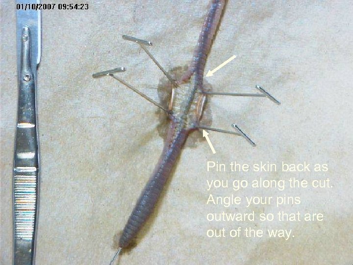 Pin the skin back as you go along the cut. Angle your pins outward