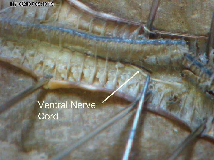 Ventral Nerve Cord 