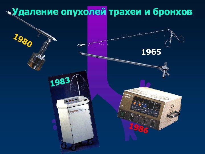 Удаление опухолей трахеи и бронхов 19 80 1965 1983 198 6 