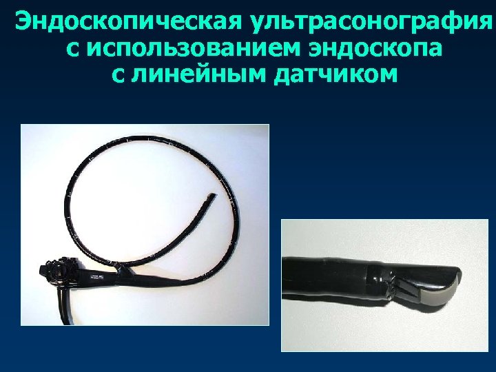 Эндоскопическая ультрасонография с использованием эндоскопа с линейным датчиком 