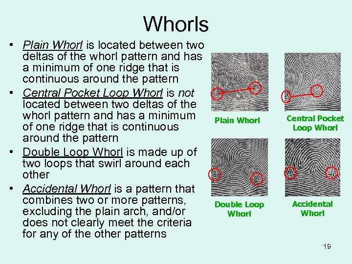 Whorls • Plain Whorl is located between two deltas of the whorl pattern and
