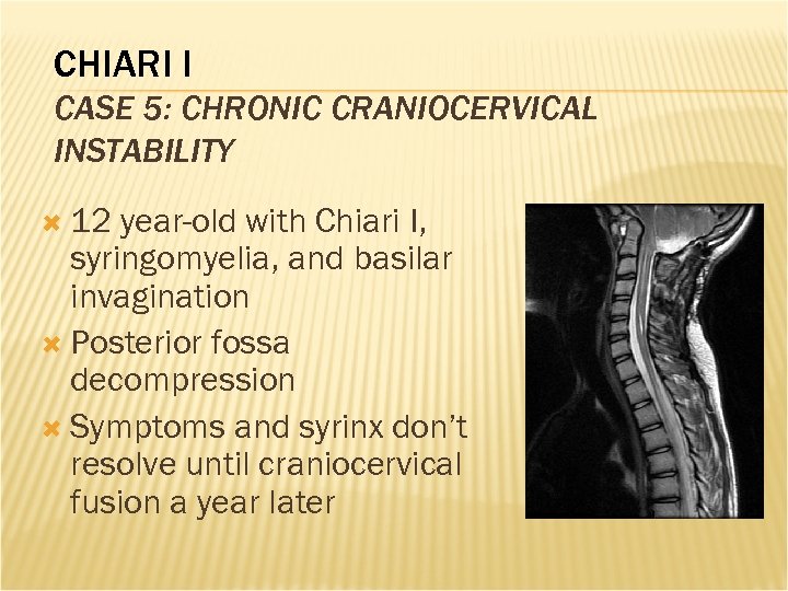 CHIARI I CASE 5: CHRONIC CRANIOCERVICAL INSTABILITY 12 year-old with Chiari I, syringomyelia, and
