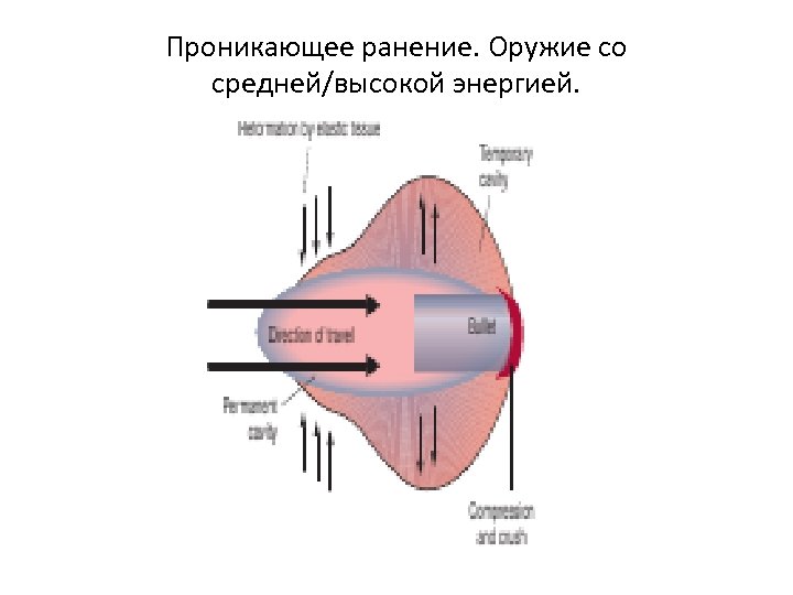 Проникающее ранение. Оружие со средней/высокой энергией. 