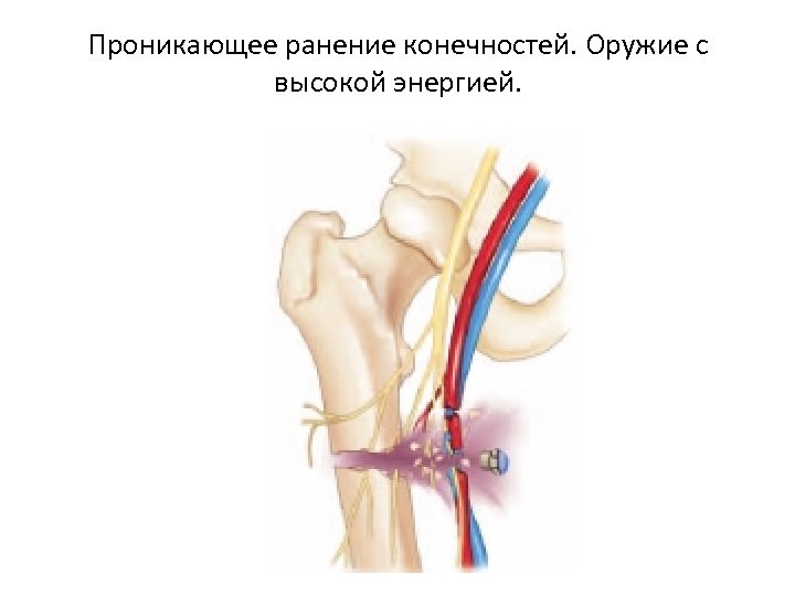 Пр никнуть. Проникающие и непроникающие раны. Проникающие ранения хирургия.