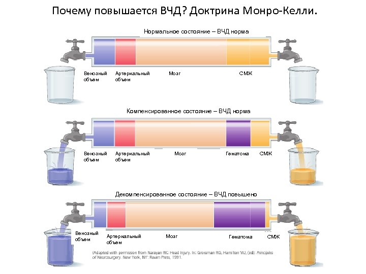 Почему повышается ВЧД? Доктрина Монро-Келли. Нормальное состояние – ВЧД норма Венозный объем Артериальный объем