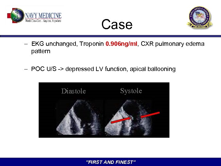 Case – EKG unchanged, Troponin 0. 906 ng/ml, CXR pulmonary edema pattern – POC