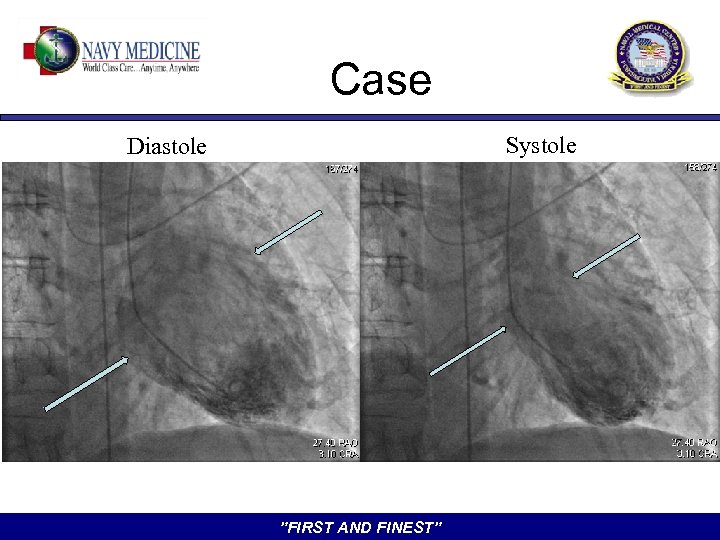 Case Systole Diastole ”FIRST AND FINEST” 