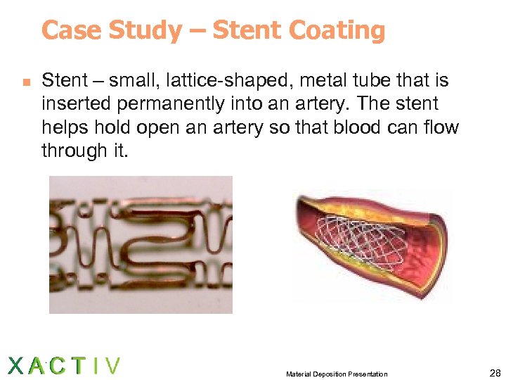 Case Study – Stent Coating n Stent – small, lattice-shaped, metal tube that is