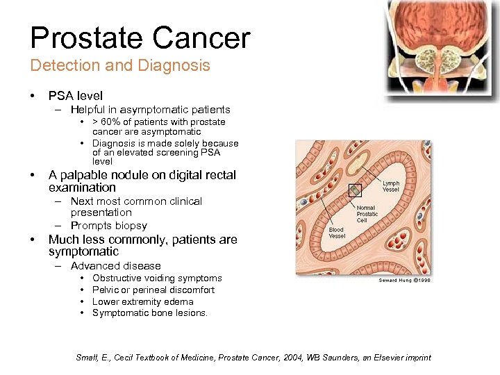 Prostate Cancer Detection and Diagnosis • PSA level – Helpful in asymptomatic patients •