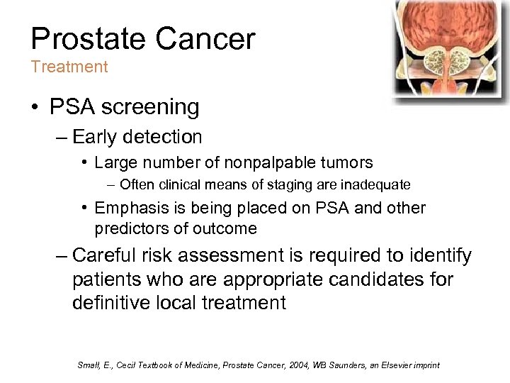 Prostate Cancer Treatment • PSA screening – Early detection • Large number of nonpalpable