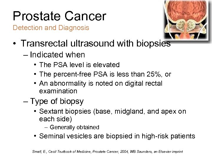 Prostate Cancer Detection and Diagnosis • Transrectal ultrasound with biopsies – Indicated when •