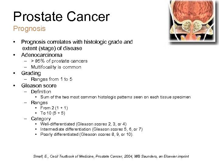 Prostate Cancer Prognosis • • Prognosis correlates with histologic grade and extent (stage) of