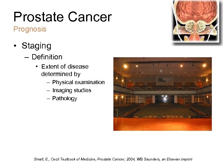 Prostate Cancer Prognosis • Staging – Definition • Extent of disease determined by –