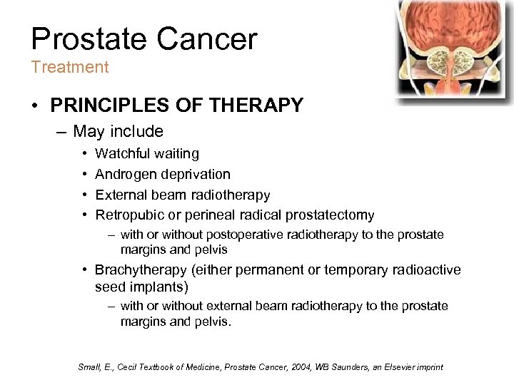 Prostate Cancer Treatment • PRINCIPLES OF THERAPY – May include • • Watchful waiting