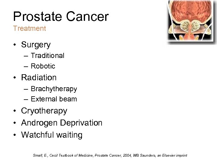 Prostate Cancer Treatment • Surgery – Traditional – Robotic • Radiation – Brachytherapy –
