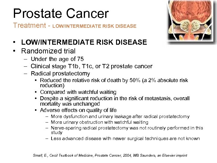 Prostate Cancer Treatment - LOW/INTERMEDIATE RISK DISEASE • LOW/INTERMEDIATE RISK DISEASE • Randomized trial