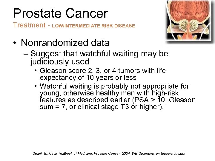 Prostate Cancer Treatment - LOW/INTERMEDIATE RISK DISEASE • Nonrandomized data – Suggest that watchful
