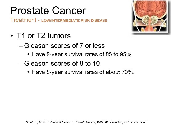 Prostate Cancer Treatment - LOW/INTERMEDIATE RISK DISEASE • T 1 or T 2 tumors