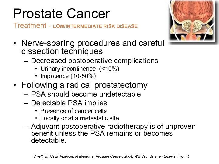 Prostate Cancer Treatment - LOW/INTERMEDIATE RISK DISEASE • Nerve-sparing procedures and careful dissection techniques