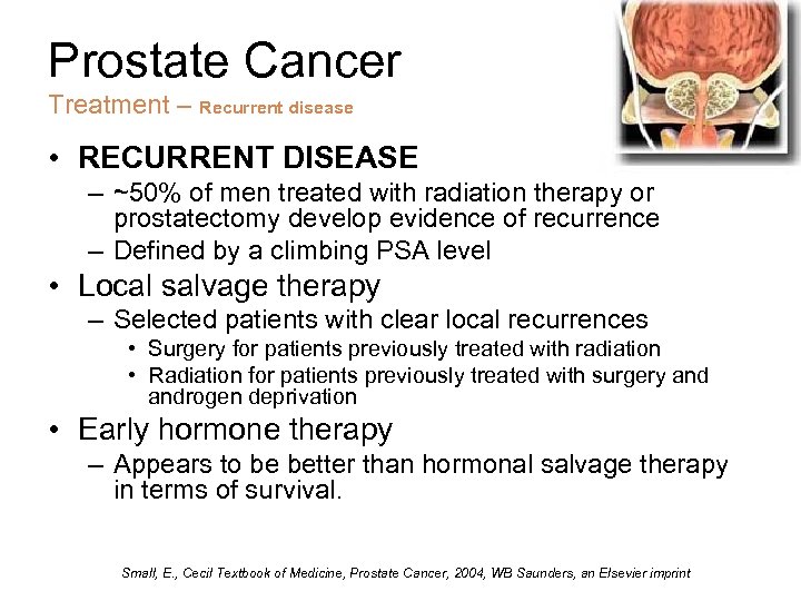 Prostate Cancer Treatment – Recurrent disease • RECURRENT DISEASE – ~50% of men treated