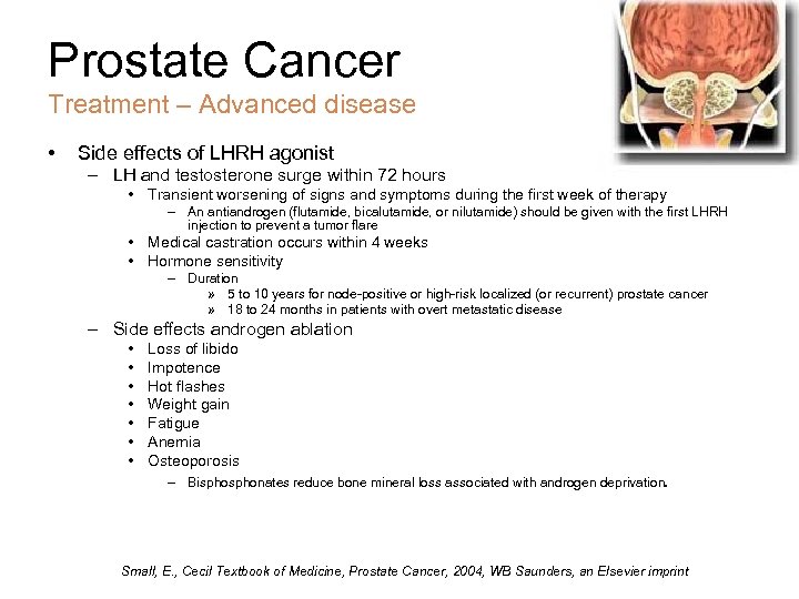 Prostate Cancer Treatment – Advanced disease • Side effects of LHRH agonist – LH