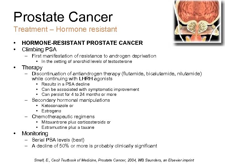 Prostate Cancer Treatment – Hormone resistant • • HORMONE-RESISTANT PROSTATE CANCER Climbing PSA –