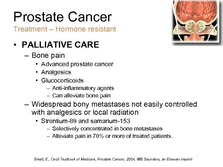 Prostate Cancer Treatment – Hormone resistant • PALLIATIVE CARE – Bone pain • Advanced