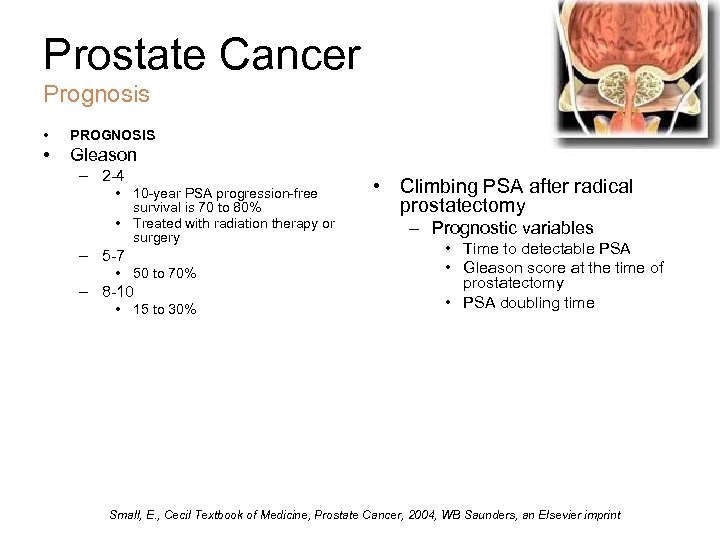 Prostate Cancer Prognosis • PROGNOSIS • Gleason – 2 -4 • 10 -year PSA
