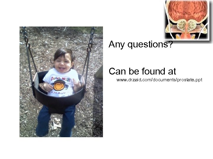 Any questions? Can be found at www. drzaid. com/documents/prostate. ppt 