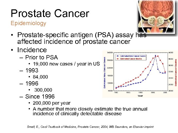 Prostate Cancer Epidemiology • Prostate-specific antigen (PSA) assay has affected incidence of prostate cancer