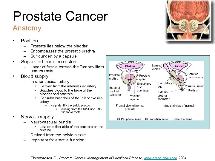 Prostate Cancer Anatomy • Position – Prostate lies below the bladder – Encompasses the