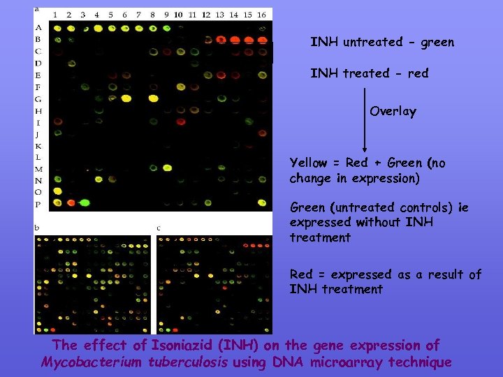 INH untreated - green INH treated - red Overlay Yellow = Red + Green