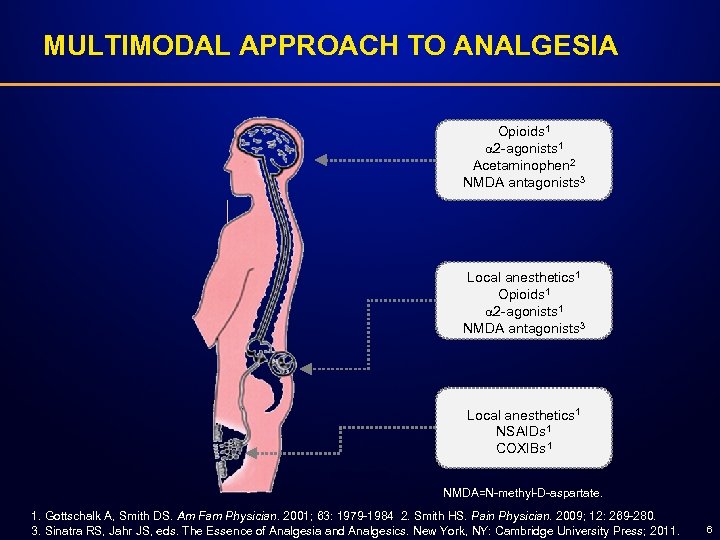 MULTIMODAL APPROACH TO ANALGESIA Opioids 1 2 -agonists 1 Acetaminophen 2 NMDA antagonists 3