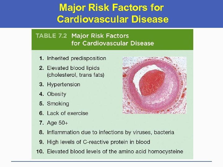 Major Risk Factors for Cardiovascular Disease 