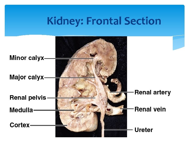 Kidney: Frontal Section 