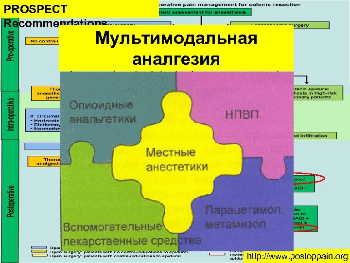 PROSPECT Recommendations Мультимодальная аналгезия http: //www. postoppain. org 