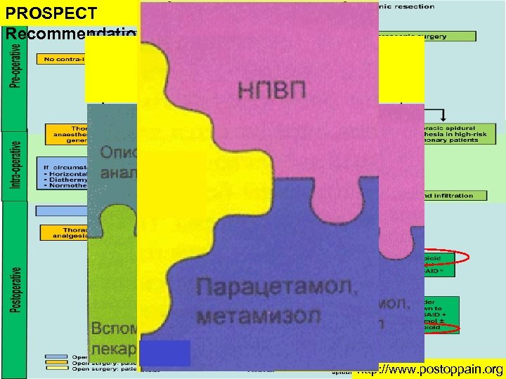 PROSPECT Recommendations Мультимодальная аналгезия http: //www. postoppain. org 