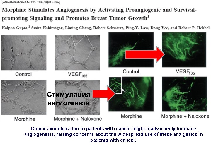 Стимуляция ангиогенеза Оpioid administration to patients with cancer might inadvertently increase angiogenesis, raising concerns