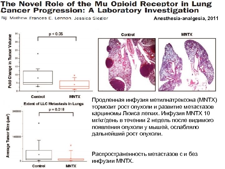Anesthesia-analgesia, 2011 Продленная инфузия метилнатрексона (MNTX) тормозит рост опухоли и развитие метастазов карциномы Люиса