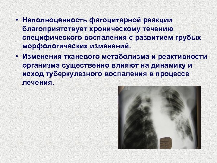  • Неполноценность фагоцитарной реакции благоприятствует хроническому течению специфического воспаления с развитием грубых морфологических