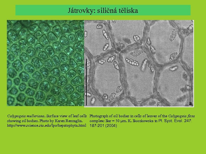 Játrovky: siličná tělíska Calypogeia mulleriana. Surface view of leaf cells Photograph of oil bodies