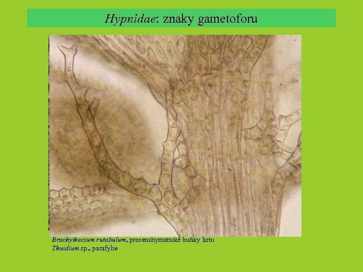 Hypnidae: znaky gametoforu Brachythecium rutabulum, prosenchymatické buňky listu Thuidium sp. , parafylie 
