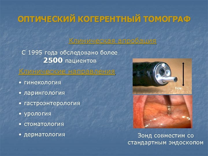 ОПТИЧЕСКИЙ КОГЕРЕНТНЫЙ ТОМОГРАФ Клиническая апробация С 1995 года обследовано более 2500 пациентов Клинические направления