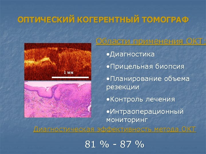 ОПТИЧЕСКИЙ КОГЕРЕНТНЫЙ ТОМОГРАФ Области применения ОКТ: • Диагностика 1 мм • Прицельная биопсия •