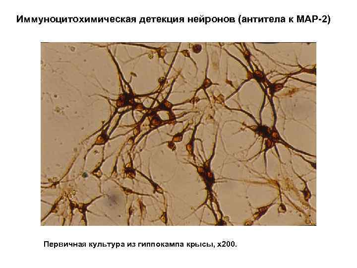 Иммуноцитохимическая детекция нейронов (антитела к МАР-2) Первичная культура из гиппокампа крысы, х200. 
