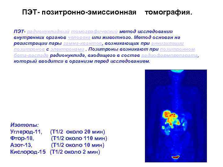 ПЭТ- позитронно-эмиссионная томография. ПЭТ- радионуклидный томографический метод исследования внутренних органов человека или животного. Метод