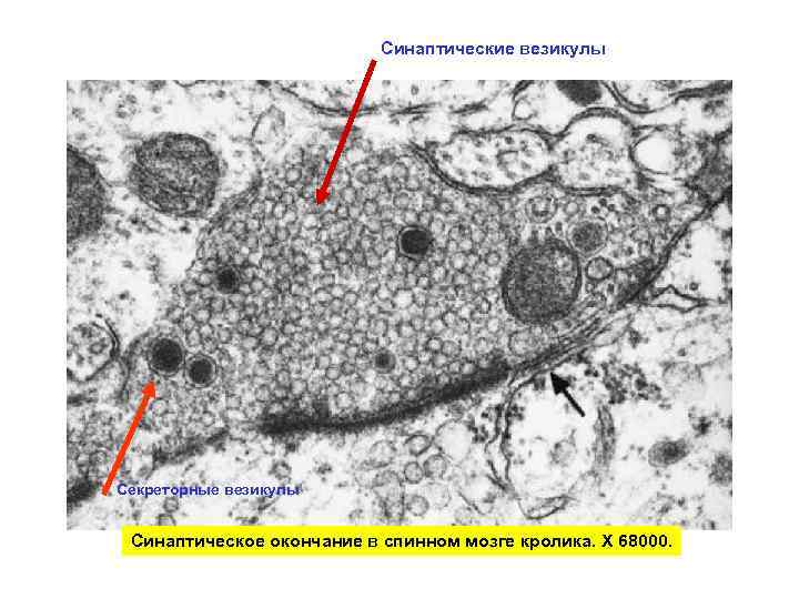 Везикула. Синаптические везикулы. Микрофотографии синаптической везикулы.