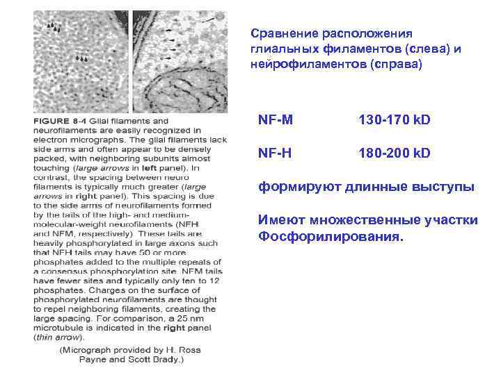 Сравнение расположения глиальных филаментов (слева) и нейрофиламентов (справа) NF-M 130 -170 k. D NF-H